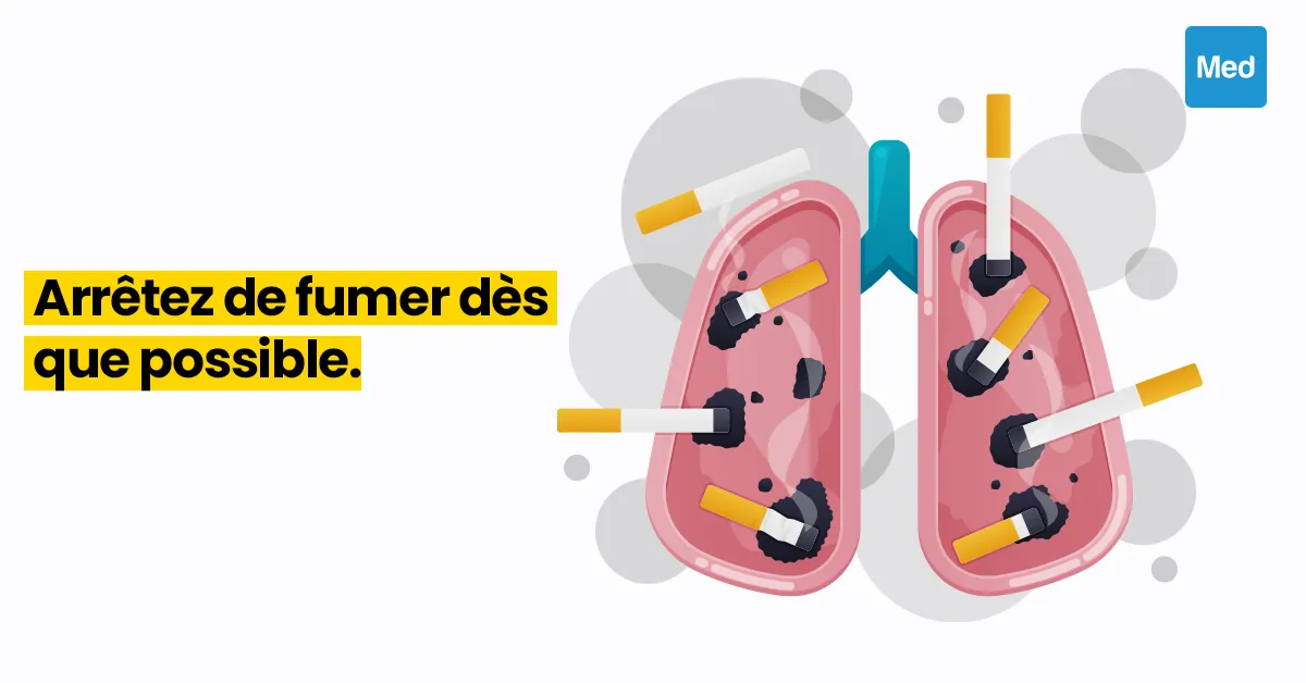 Les dangers du tabagisme et comment arrêter 